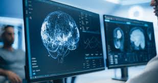 Neurologie et Imagerie Médicale